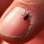 Ticks Suck. Here’s A Guide To Identifying Them And Avoiding Bites